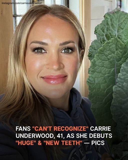Carrie Underwood, 41, Sparks Stir as Fans Claim She ‘Does Not Look Like’ Herself and Suspect ‘New Teeth’
