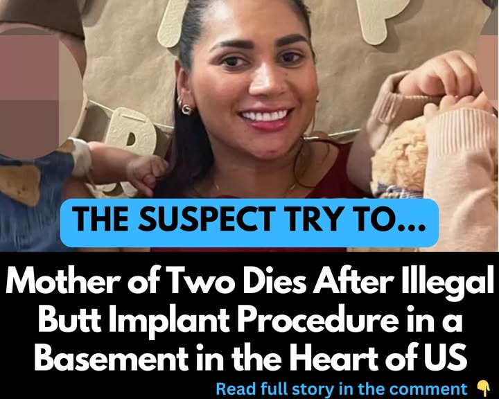Mother of Two Dies After Illegal Butt Implant Procedure in a Basement in the Heart of US