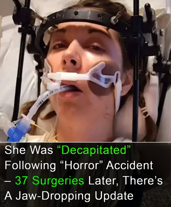 Woman survives being ‘decapitated’ after doctors reattach head