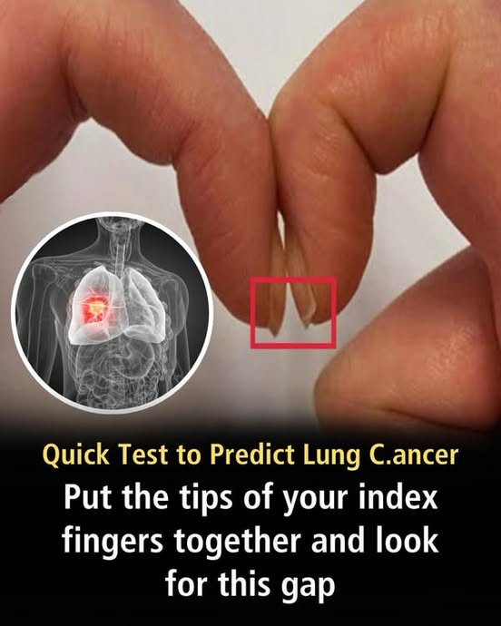 Doctor-approved finger test warns of serious health conditions