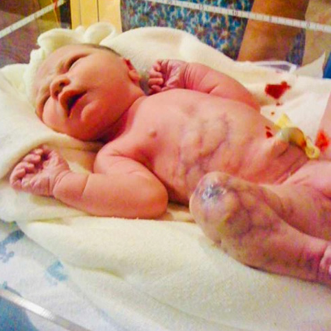 Mom delivers baby, only for dad to utter: “There’s something wrong”